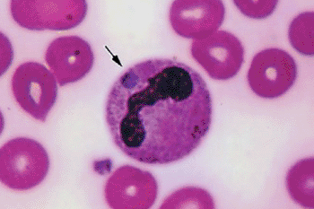 Imagen: El Anaplasma phagocytophilum, el agente causante de la anaplasmosis (Fotografía cortesía de Medscape).